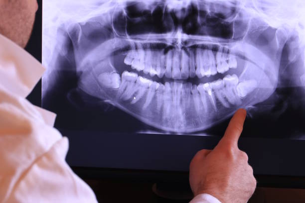 Best Emergency Dental Care for Broken or Chipped Teeth in Hillsbo, OR