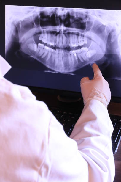Best Emergency Treatment for Dental Infections or Abscesses in Hillsbo, OR