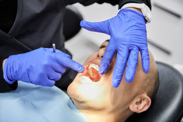 Best Emergency Root Canal Treatment in Hillsbo, OR